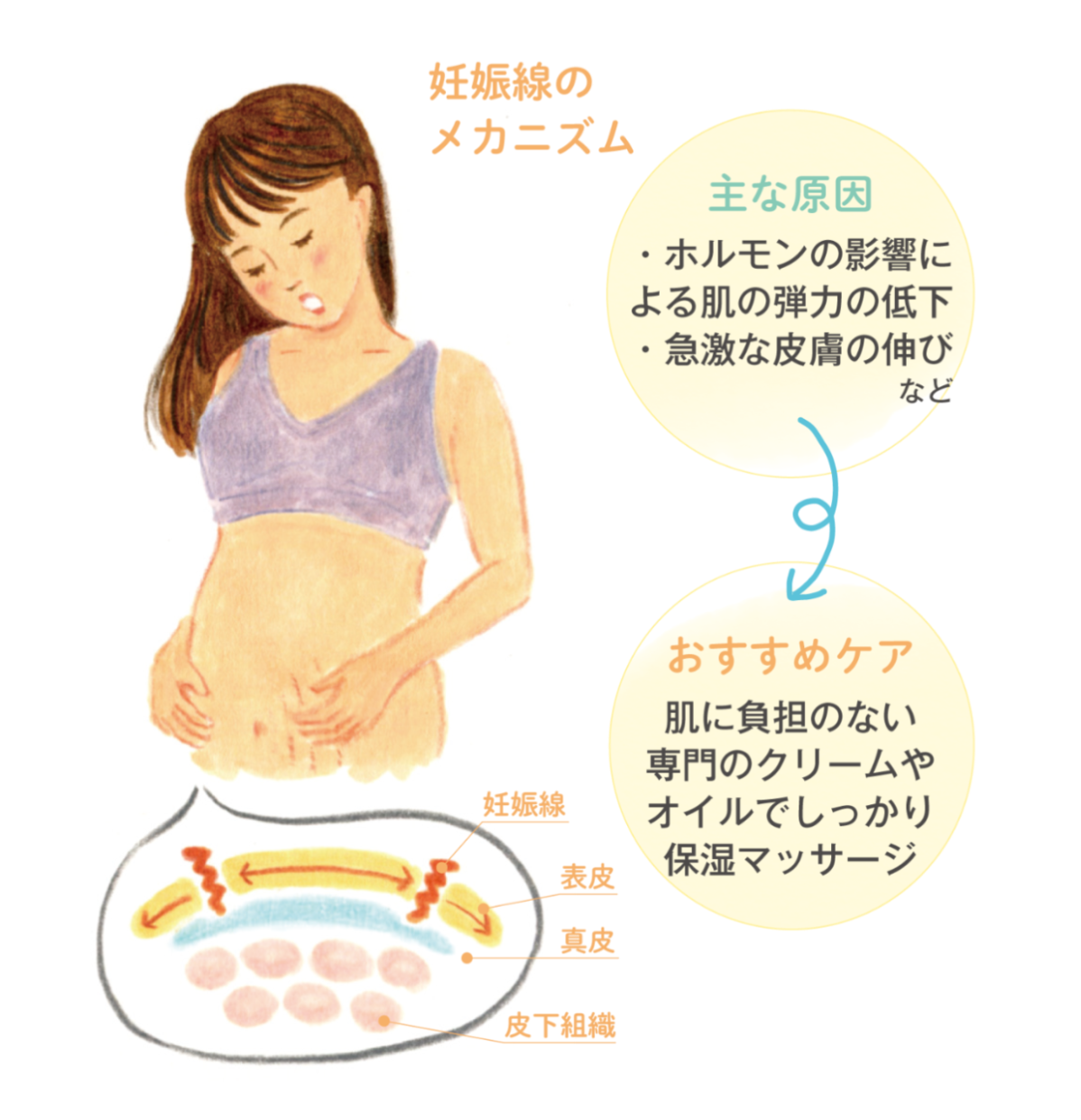 妊娠線の予防 ケア